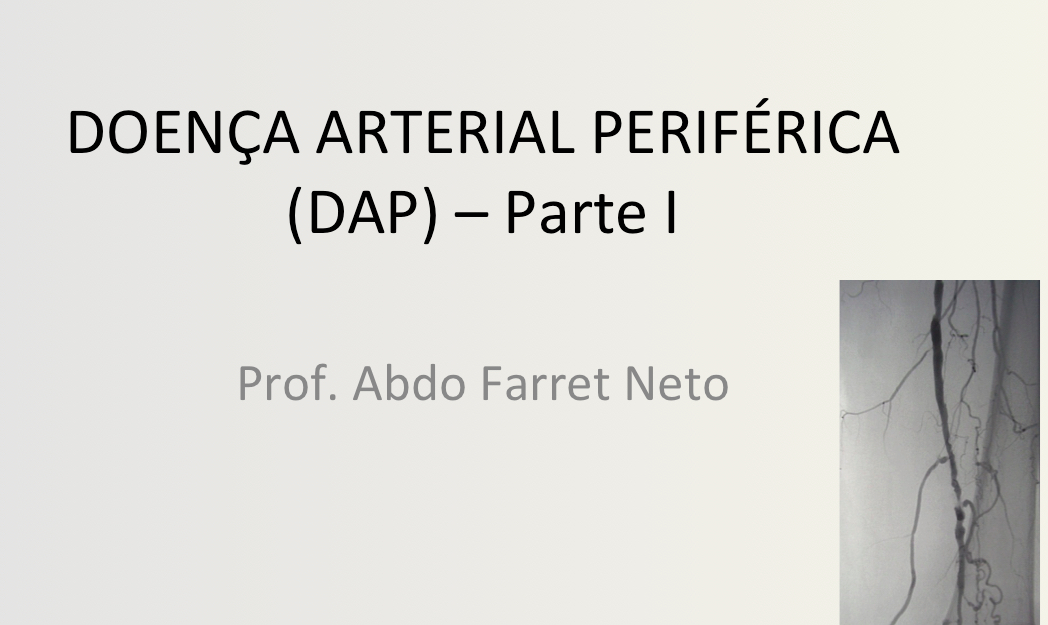 Doença arterial periférica – DAP – Parte I