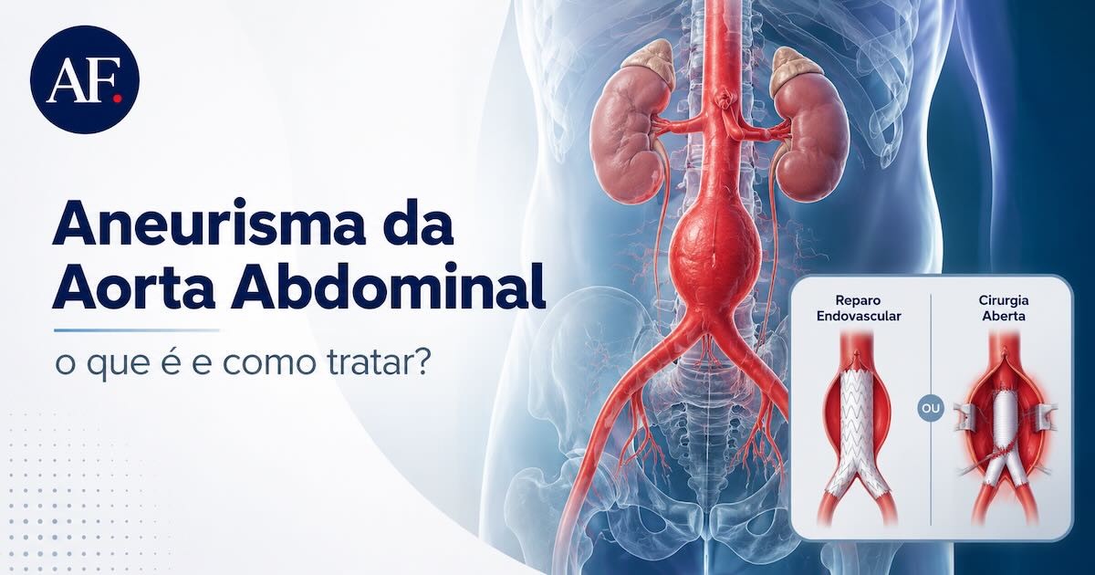 Ilustração da aorta abdominal com aneurisma e comparação entre reparo endovascular e cirurgia aberta