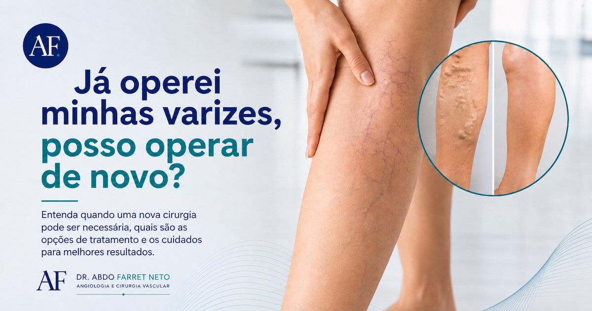 Perna com varizes recidivadas e detalhe ampliado das veias, sob o título Já operei minhas varizes, posso operar de novo?