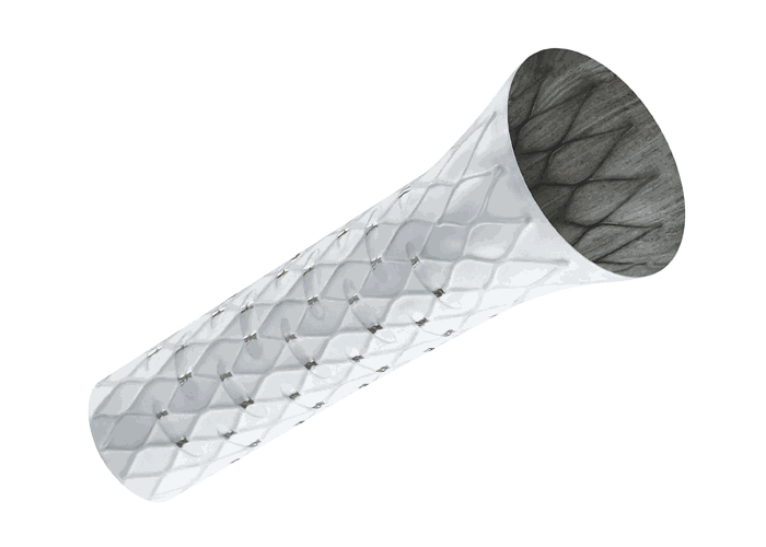 Stent revestido, com cobertura de tecido sobre a malha