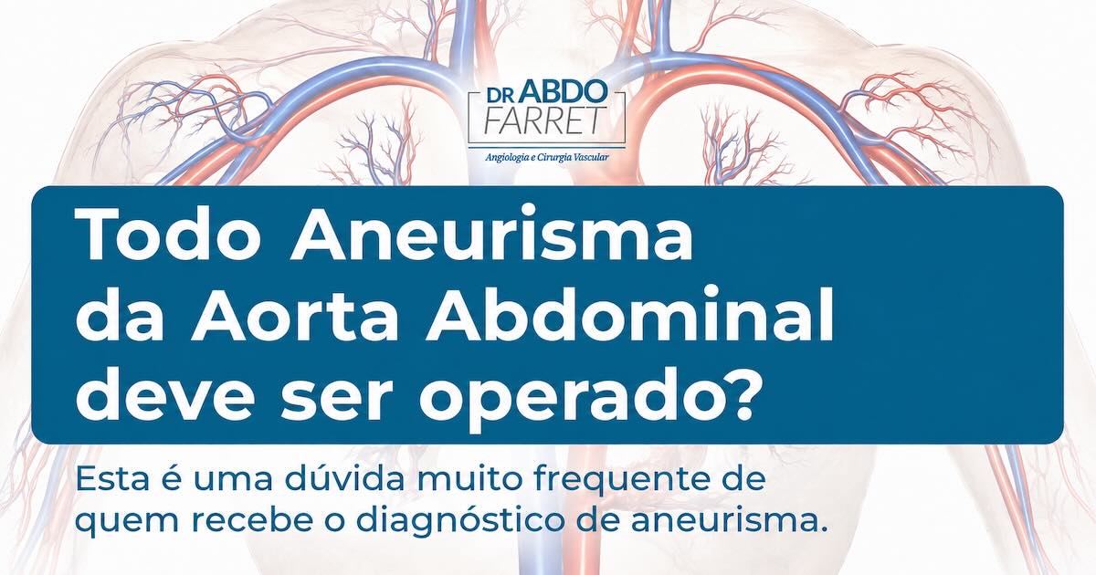 Ilustração da aorta abdominal e seus ramos ao fundo, com o título Todo Aneurisma da Aorta Abdominal deve ser operado?