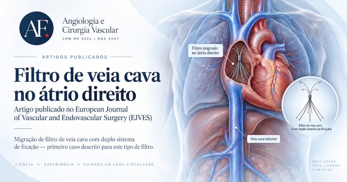 Ilustração do tórax com o filtro de veia cava que migrou pela veia cava inferior até o átrio direito do coração, e detalhe ampliado do filtro com duplo sistema de fixação